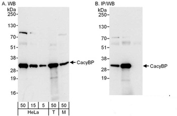 Rabbit anti-CacyBP Antibody