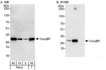 CacyBP Antibody