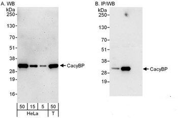 Rabbit anti-CacyBP Antibody