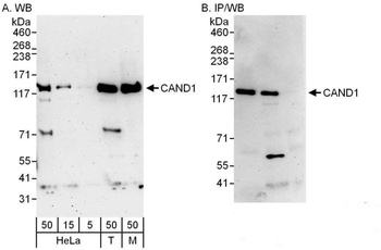 Rabbit anti-CAND1 Antibody