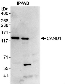 Rabbit anti-CAND1 Antibody