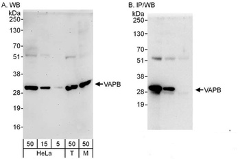Rabbit anti-VAPB Antibody