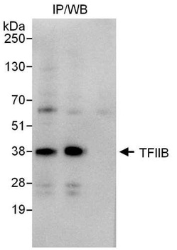 GTF2B/TFIIB Antibody