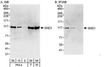 Rabbit anti-SND1 Antibody