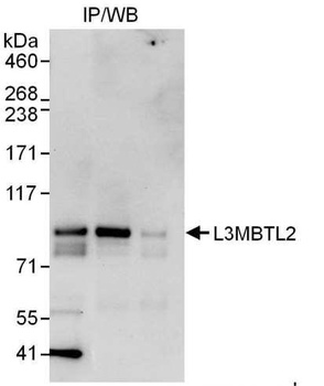 L3MBTL2 Antibody