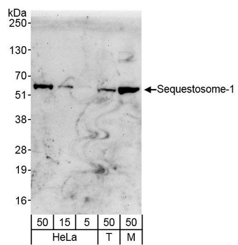 Sequestosome-1 Antibody