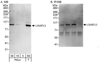 Rabbit anti-L3MBTL3 Antibody