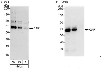 Rabbit anti-CAR Antibody