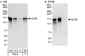 Rabbit anti-SLTM Antibody
