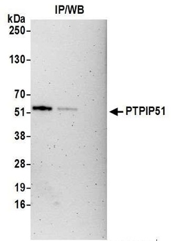 PTPIP51 Antibody