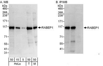 Rabbit anti-RABEP1 Antibody