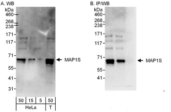 Rabbit anti-MAP1S Antibody