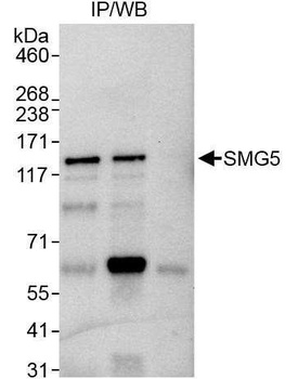 SMG5 Antibody
