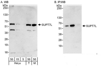 Rabbit anti-SUPT7L Antibody