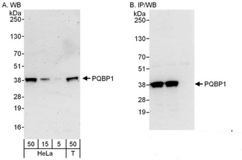 Rabbit anti-PQBP1 Antibody