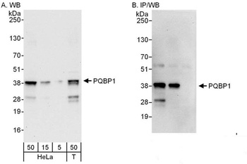 Rabbit anti-PQBP1 Antibody