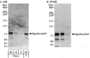 MgcRacGAP Antibody
