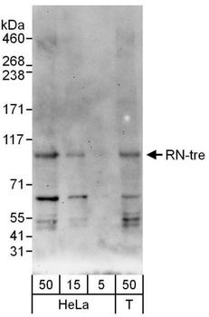 RN-tre Antibody