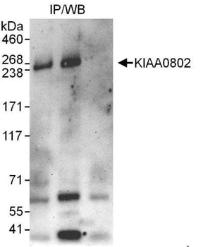 KIAA0802 Antibody