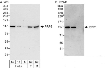 PRP6 Antibody