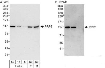 Rabbit anti-PRP6 Antibody