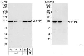 PRP6 Antibody
