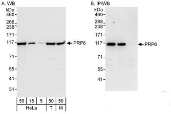 Rabbit anti-PRP6 Antibody