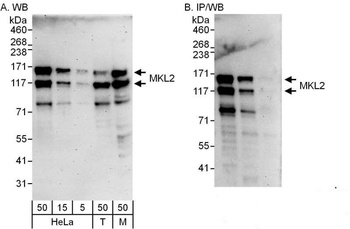 Rabbit anti-MKL2 Antibody