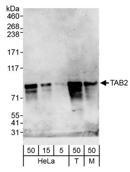 TAB2 Antibody