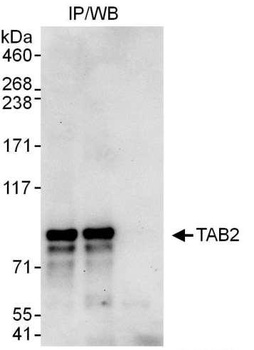 TAB2 Antibody