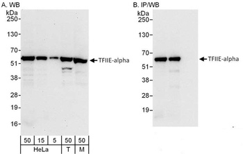Rabbit anti-GTF2E1/TFIIE-alpha Antibody