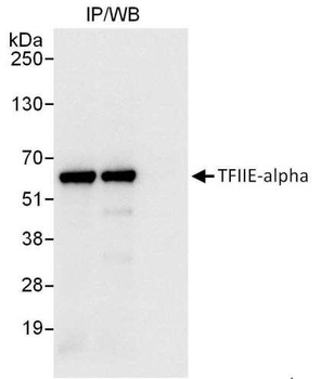 Rabbit anti-GTF2E1/TFIIE-alpha Antibody