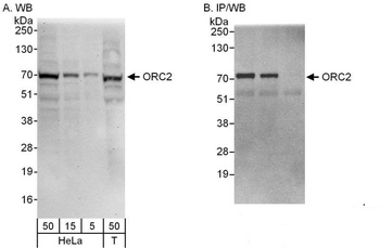 Rabbit anti-ORC2 Antibody