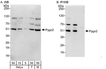 Rabbit anti-Pygo2 Antibody