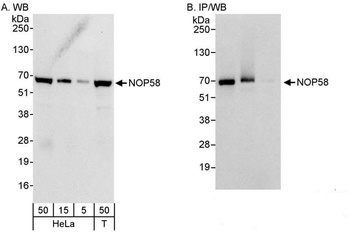 NOP58 Antibody