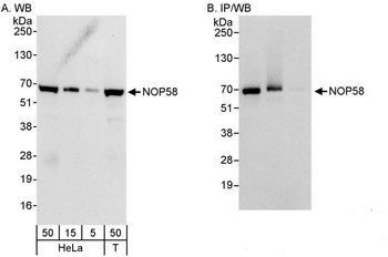 Rabbit anti-NOP58 Antibody