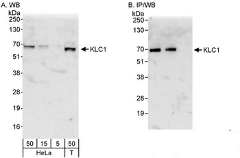Rabbit anti-KLC1 Antibody