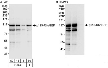 p115-RhoGEF Antibody