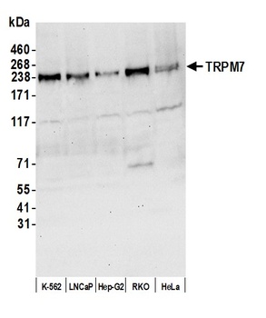 TRPM7 Antibody