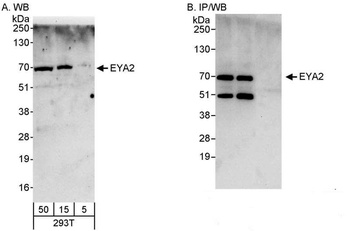 Rabbit anti-EYA2 Antibody