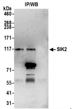 SIK2 Antibody