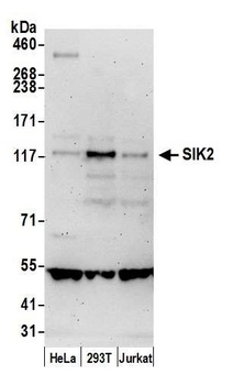 SIK2 Antibody