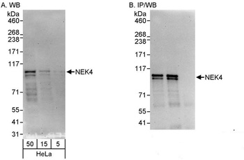 Rabbit anti-NEK4 Antibody