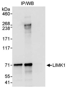 LIMK1 Antibody