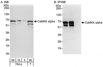 Rabbit anti-CaMKK alpha Antibody