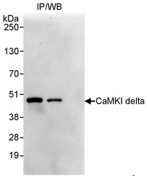 CaMKI delta Antibody