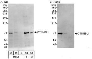 Rabbit anti-CTNNBL1 Antibody