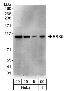 Rabbit anti-ERK5 Antibody