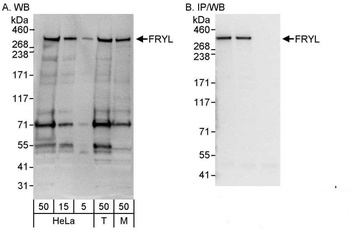 Rabbit anti-FRYL Antibody