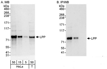 Rabbit anti-LPP Antibody